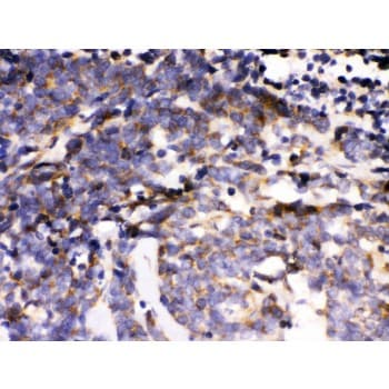 MAPK6 / ERK3 Antibody (aa520-721)