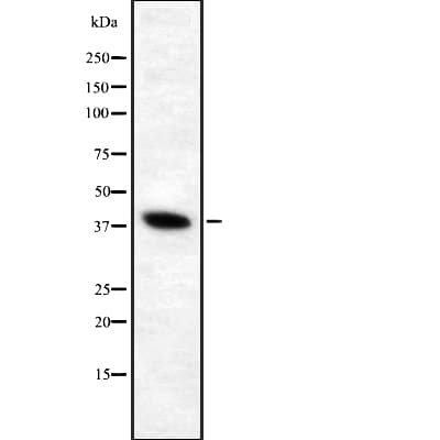 ATP6V0D1 Antibody