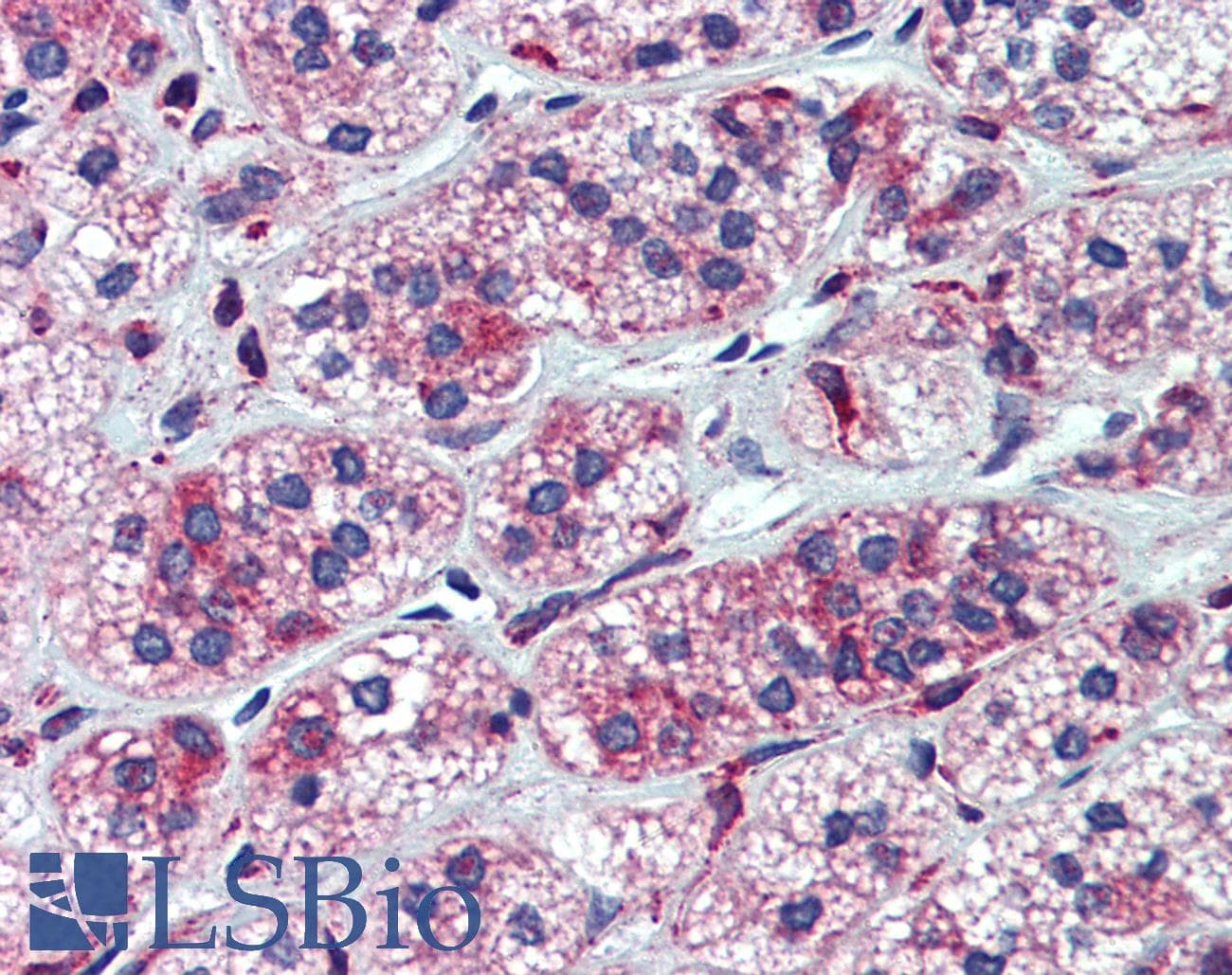 Polyclonal Rabbit anti-Human P450SCC / CYP11A1 Antibody (aa288-337, IHC, WB)