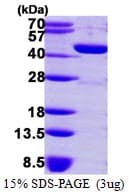Human GMDS / GMD Protein (Recombinant His)