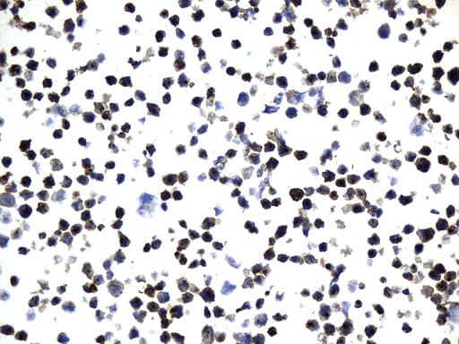MME / CD10 Antibody (aa411-750, clone UMAB235)