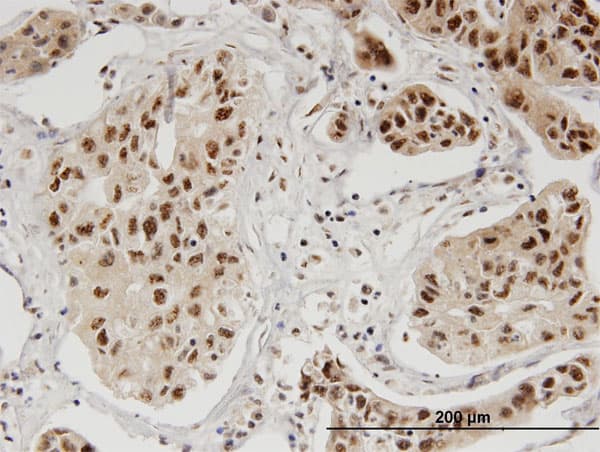 Monoclonal Mouse anti-Human PBK / TOPK Antibody (clone 5E1, IHC)