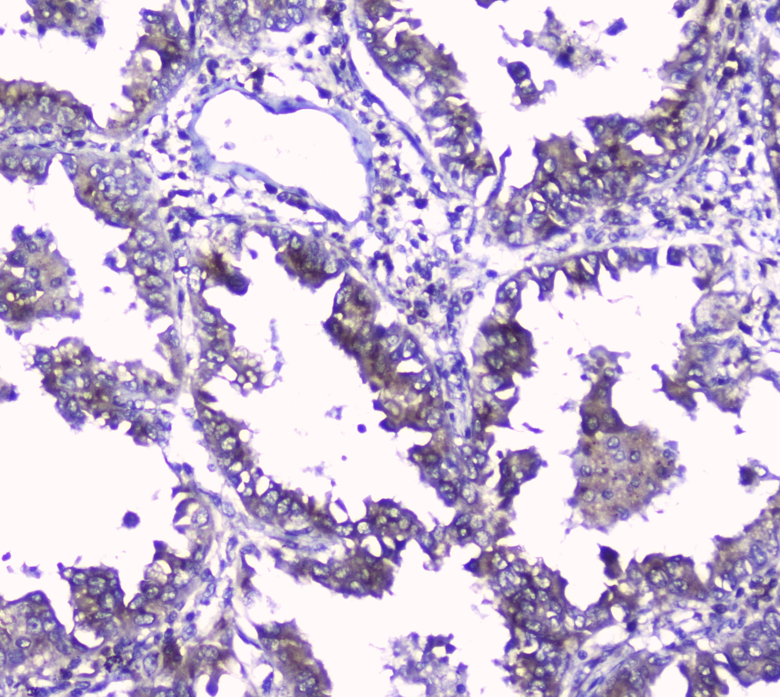 Polyclonal Rabbit anti-Human GOLPH3 Antibody (IHC, WB)