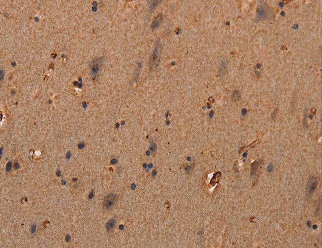 Endostatin Antibody