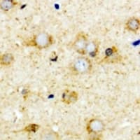 TCN2 Antibody