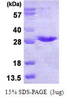 Human NKIRAS1 Protein (Recombinant His)