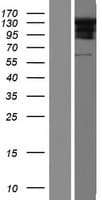 RSPH4A Protein (Over-Expression Lysate Myc-DDK (Flag))