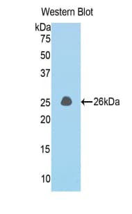 CCDC80 Antibody (aa82-288)