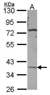 Polyclonal Rabbit anti-Human CA11 / Carbonic Anhydrase XI Antibody (aa1-311, WB)
