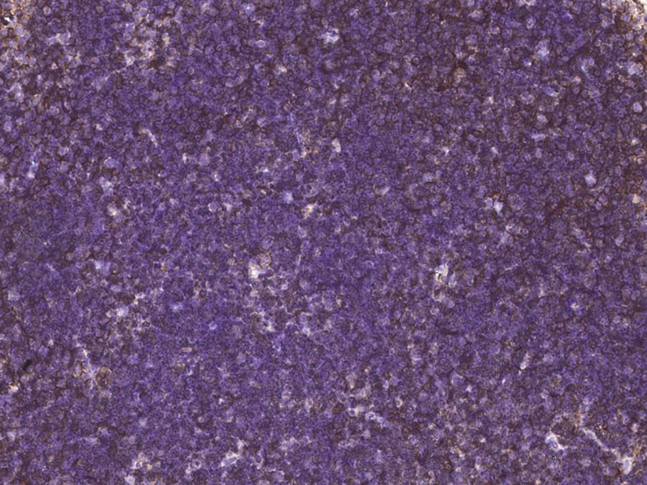 Monoclonal Rabbit anti-Mouse CD27 Antibody (clone 618, Preservative Free, IHC)
