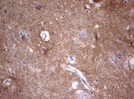 VILIP / VSNL1 Antibody (aa2-191, clone OTI7E12)