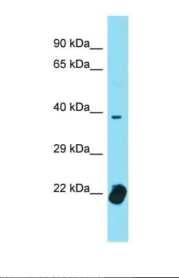 Polyclonal Rabbit anti-Human TCF12 / HEB Antibody (C-Terminus, WB)