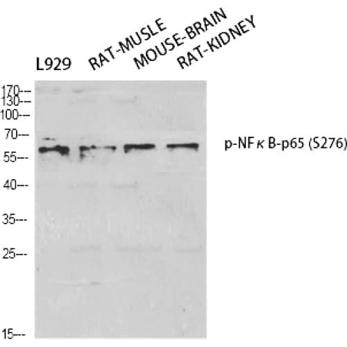 Polyclonal Rabbit anti-Human RELA / NFKB p65 Antibody (210-290 aa, IHC, WB)