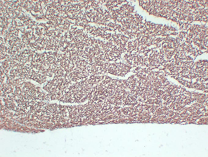 NF-L / NEFL Antibody (clone ABT-NF)