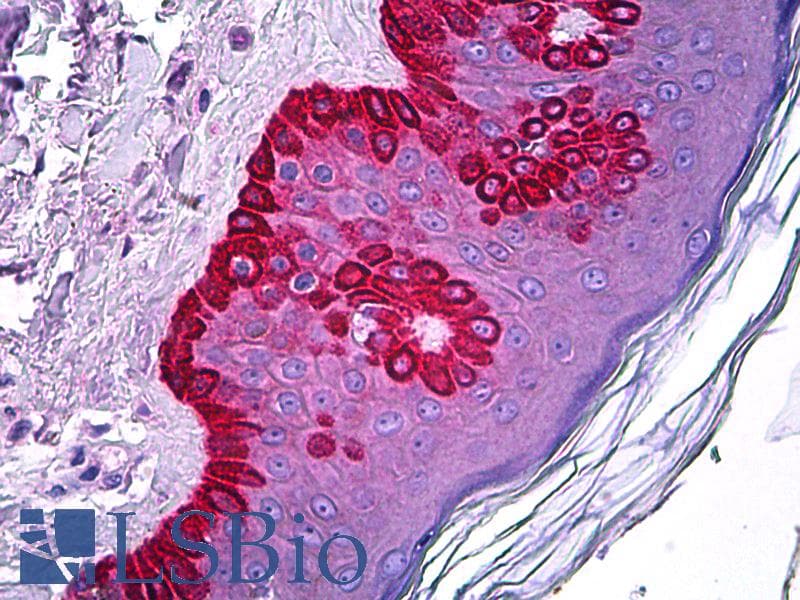 IHC-plus™ CELA1 / Pancreatic Elastase 1 Antibody (clone 4H5)