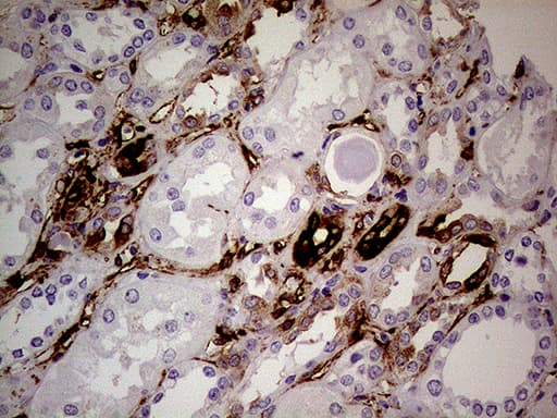 TGM2 / Transglutaminase 2 Antibody (clone OTI1A3, Carrier-free)