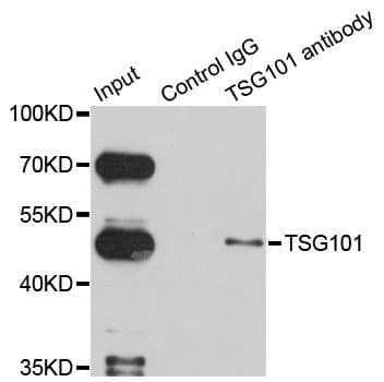 Polyclonal Rabbit anti-Human TSG101 Antibody (IHC, WB)