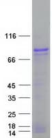 Human ALKBH8 Protein (Recombinant Myc-DDK (Flag))