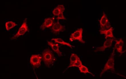 GNPAT / DHAP-AT Antibody
