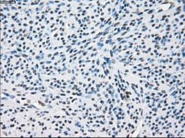 Monoclonal Mouse anti-Human ZFP36 / Tristetraprolin Antibody (clone OTI8B5, IHC, IF, WB)