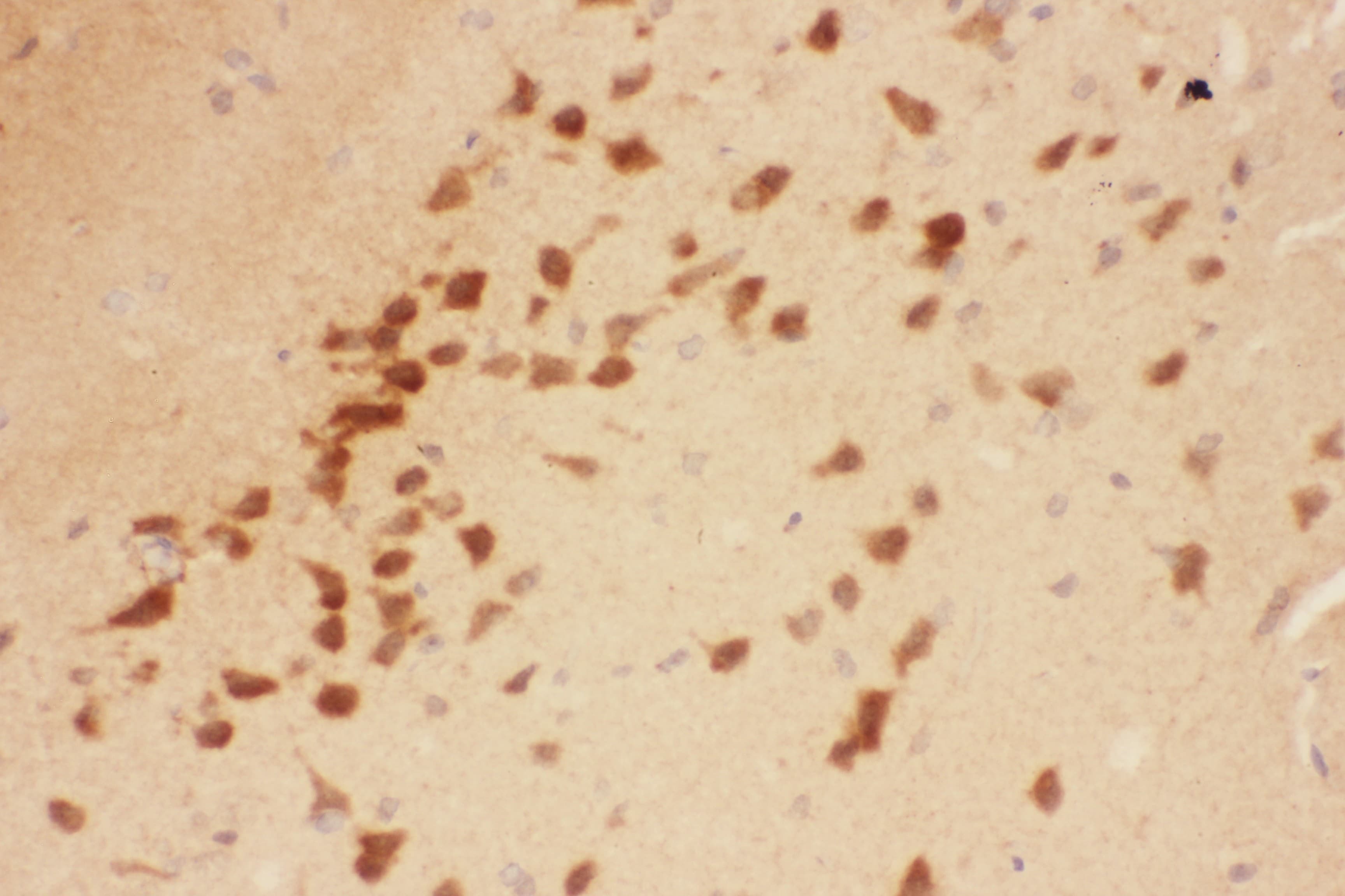 Polyclonal Rabbit anti-Human BDNF Antibody (aa129-247, IHC, WB)
