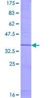 Human C14orf1 Protein (Recombinant GST)