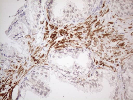 ATF1 Antibody (clone OTI7H3)