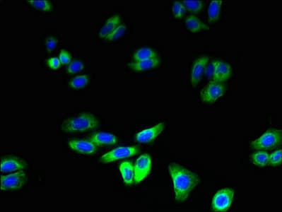 IHC-plus™ Polyclonal Rabbit anti-Human RNF128 / GRAIL Antibody (IHC, WB)