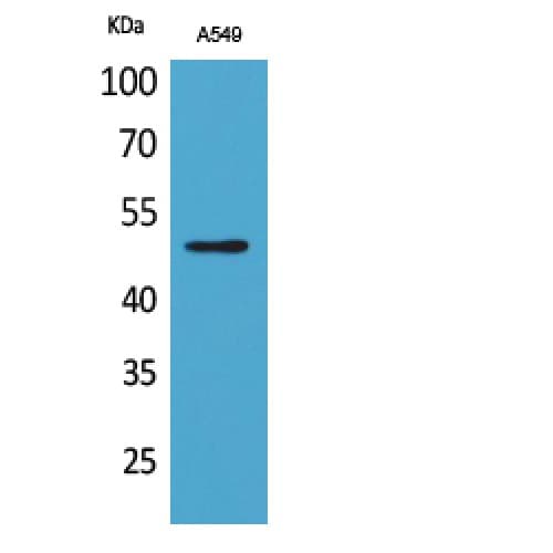 EEF1A1 + EEF1A2 Antibody (acetylation site of K41.)