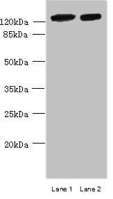 Polyclonal Rabbit anti-Human MCM9 Antibody (IHC, WB)