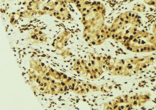 Polyclonal Rabbit anti-Human STK24 / MST3 Antibody (IHC, WB)