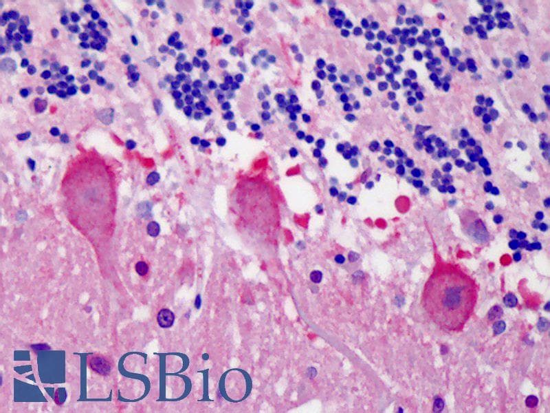 IHC-plus™ YWHAB / 14-3-3 Beta Antibody