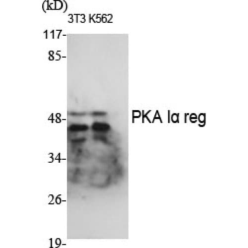 Polyclonal Rabbit anti-Human PRKAR1A Antibody (240-320 aa, C-terminal, IHC, IF, WB)