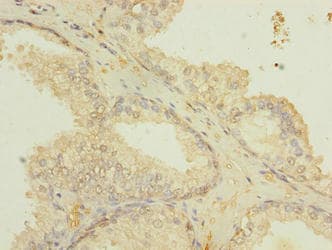 ETFDH Antibody