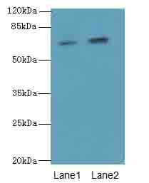 Polyclonal Rabbit anti-Human GALNT15 / GALNTL2 Antibody (IHC, WB)