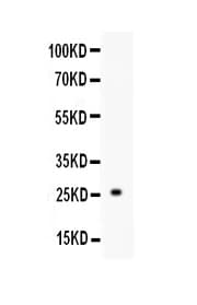 TREM1 Antibody