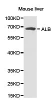ALB / Serum Albumin Antibody