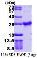 Human RAB4A / RAB4 Protein (Recombinant His)