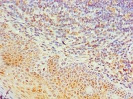 TIA-1 Antibody (aa1-193)
