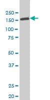 TYK2 Antibody (clone 6H1)