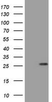 Monoclonal Mouse anti-Human BNIP1 Antibody (clone OTI2E11, WB)
