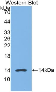 HMGN1 / HMG14 Antibody (aa1-96)