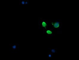 MAP2K3 / MEK3 / MKK3 Antibody (clone OTI2G8)