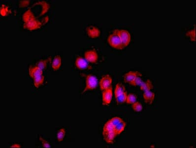 LDHD / Lactate Dehydrogenase D Antibody