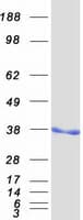 Human SMN1 Protein (Recombinant Myc-DDK (Flag))