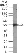RGS6 Antibody (aa182-198)