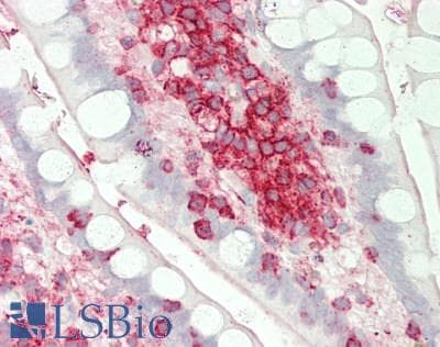 Polyclonal Rabbit anti-Human ST3GAL4 / ST3Gal IV Antibody (aa171-220, IHC, WB)