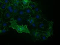 VCAM1 / CD106 Antibody (clone OTI3H10, Carrier-free)
