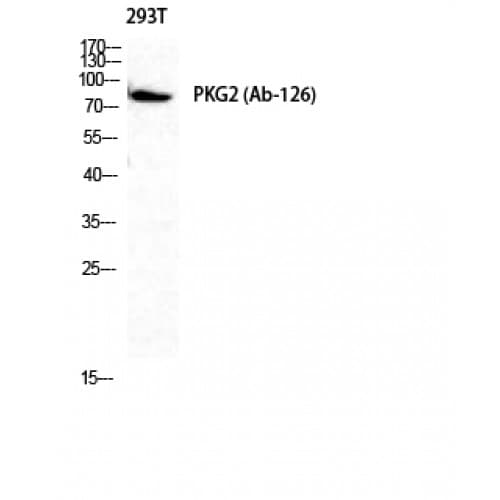 PRKG2 / CGKII Antibody (70-150 aa)
