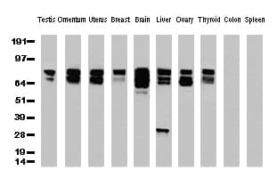 CTNNB1 / Beta Catenin Antibody (clone UMAB14)